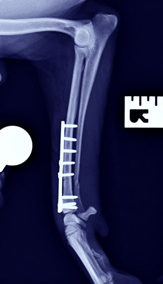 Fractures and Musculoskeletal Surgery